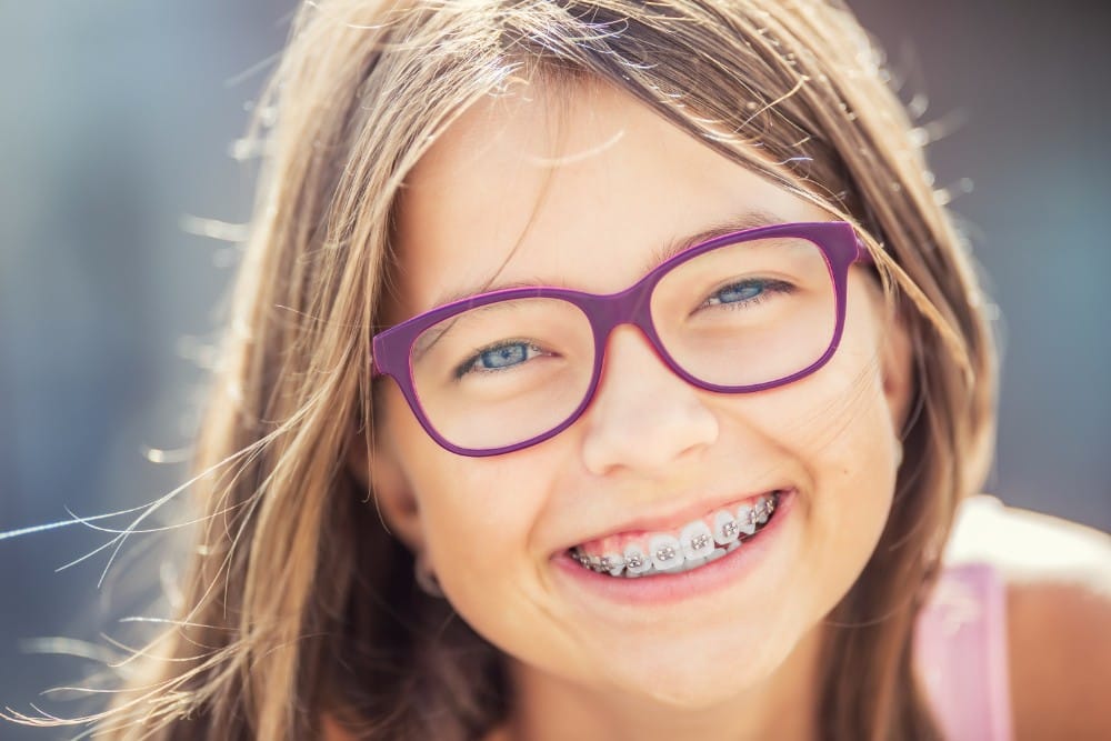 Braces as Kids