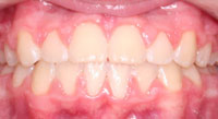 7after after