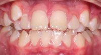 7before before