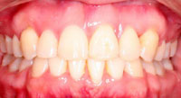 8after after