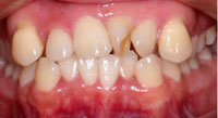 8before before