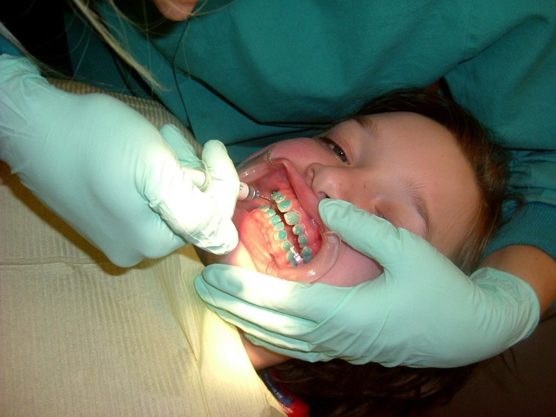 When Is the Best Time to Get Braces? Dunn Orthodontics