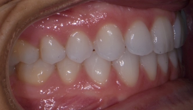 photo of smile