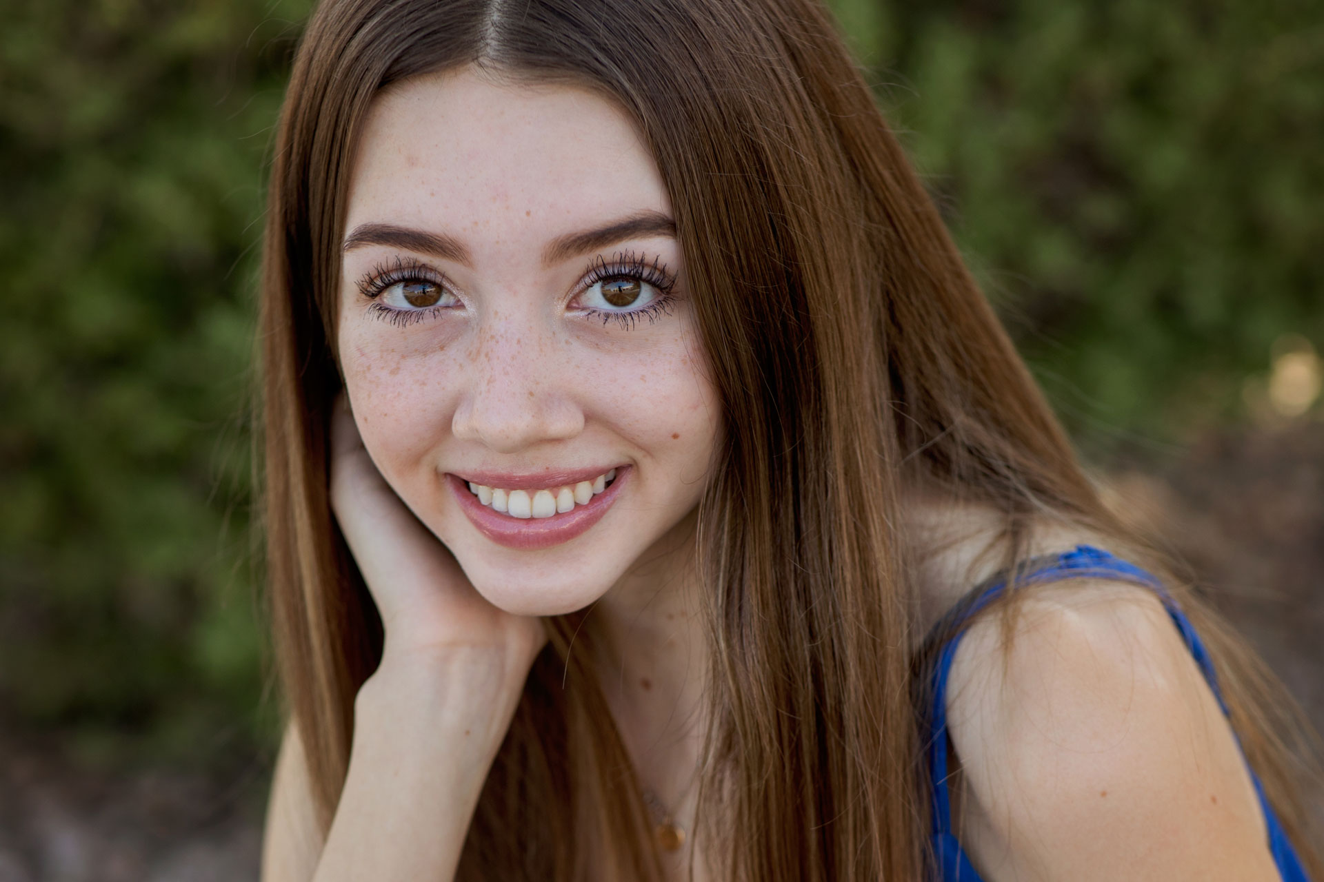 Orthodontics-Litchfield-Park Actual orthodontics Litchfield Park AZ patient